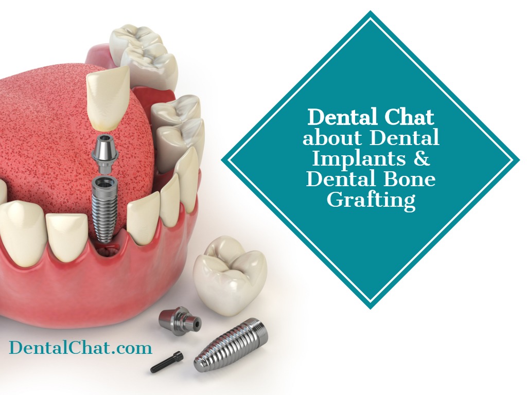 Local Dental Implant Teledentist Dentist Implants Online