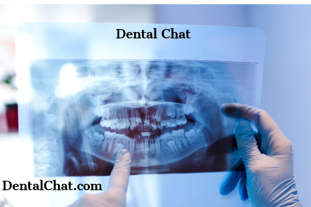 local live teledentist consult online